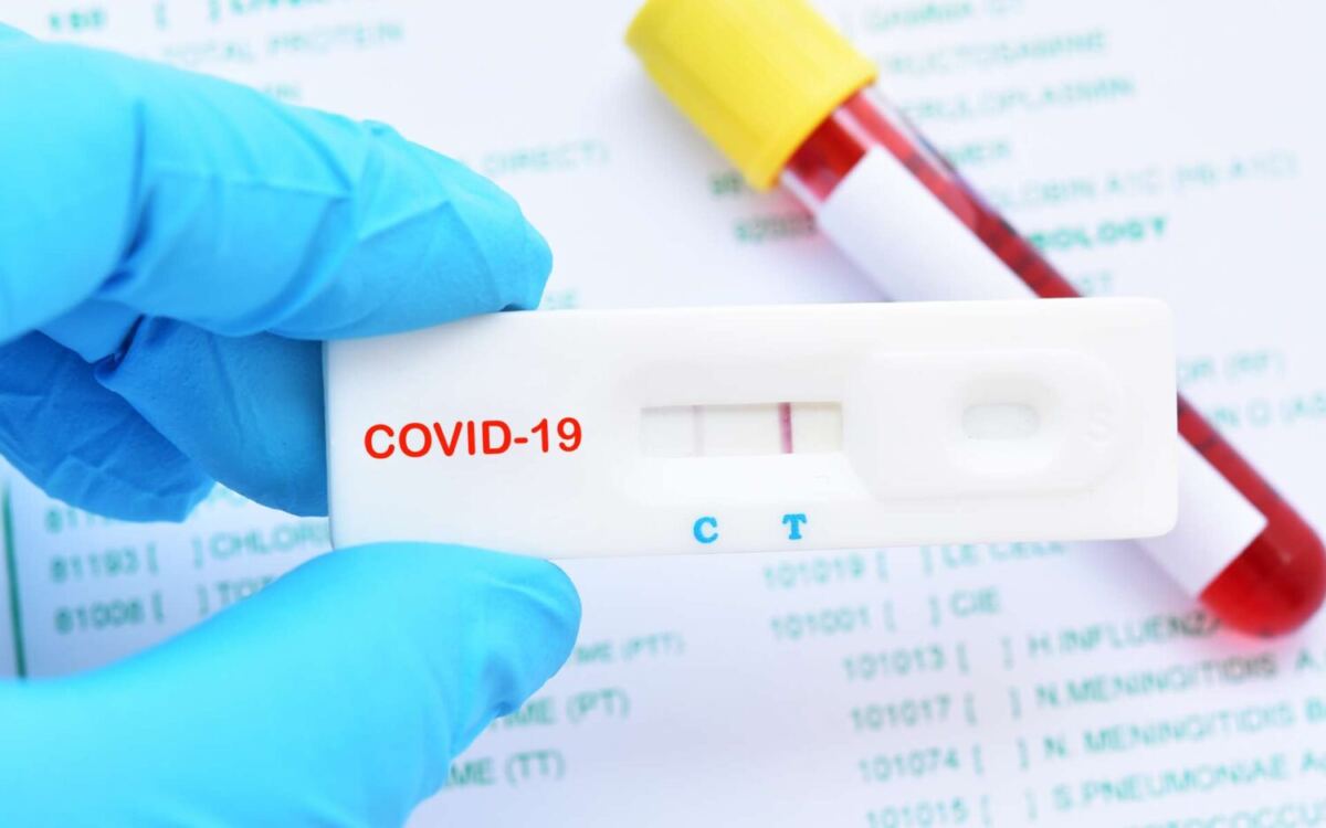 image d'un tests Covid-19.