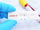 image d'un tests Covid-19.